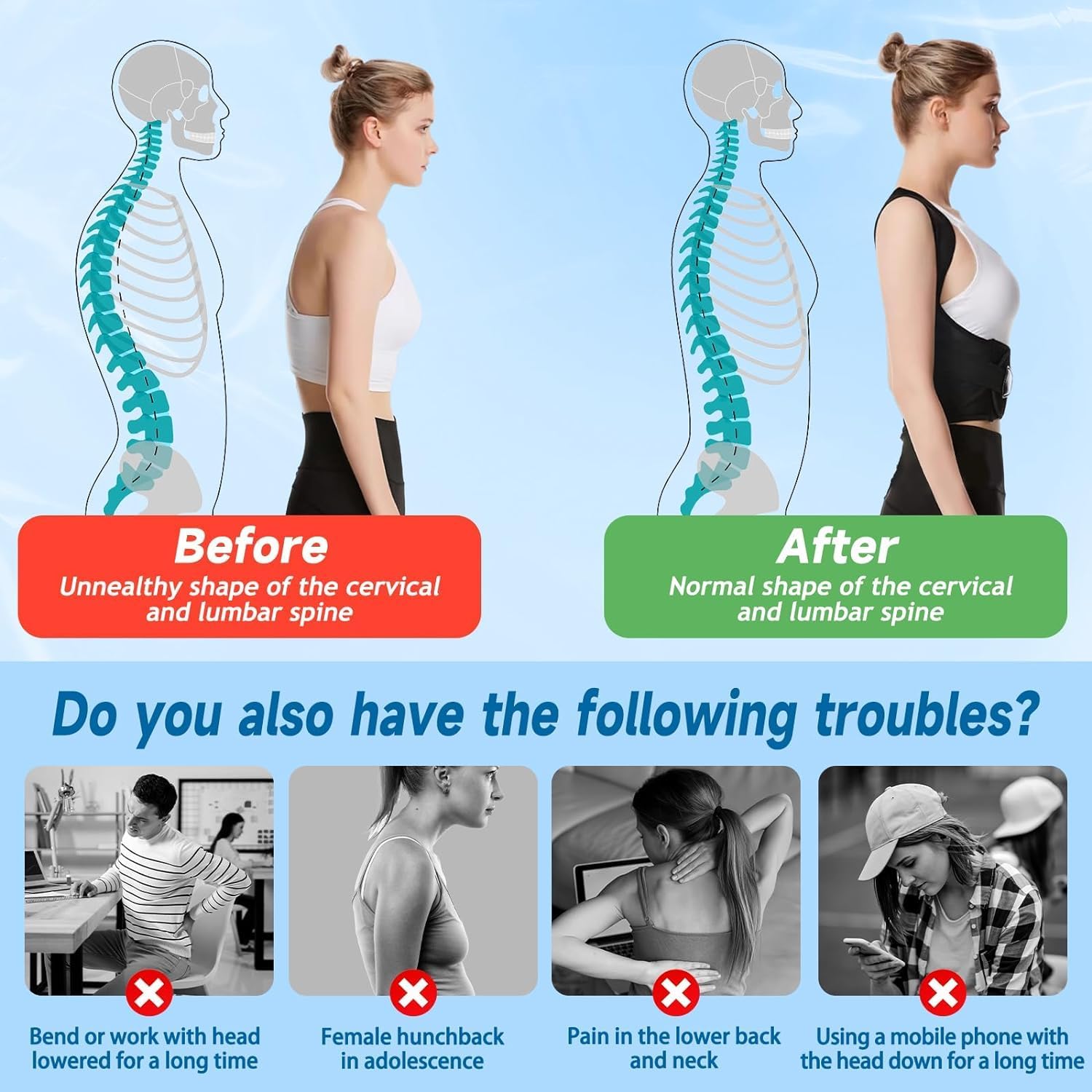 COLEESON Posture Corrector for Men and Women, Comfortable Upper Back Brace, Adjustable Back Straightener Support for Shoulder, Neck and Back - Comfort Style